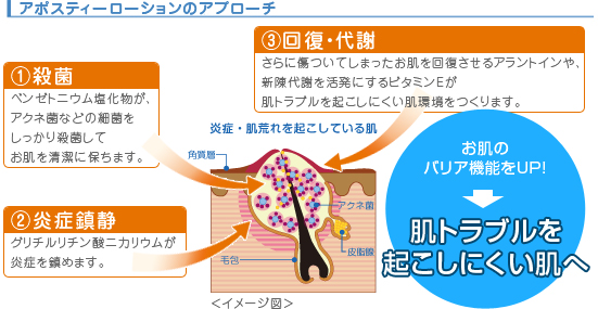 アポスティーローションのアプローチ