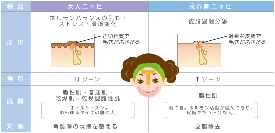 大人ニキビと思春期ニキビ